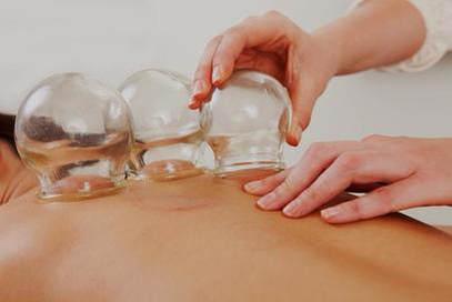 Cupping 2