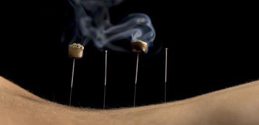 Moxibustion 3 Orig